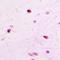 Histone Cluster 3 H3 antibody, LS-C668837, Lifespan Biosciences, Immunohistochemistry paraffin image 