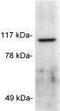 ATPase Sarcoplasmic/Endoplasmic Reticulum Ca2+ Transporting 3 antibody, GTX23339, GeneTex, Western Blot image 