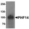 PHD Finger Protein 14 antibody, TA326658, Origene, Western Blot image 