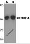 Forkhead Box O4 antibody, 5817, ProSci, Western Blot image 
