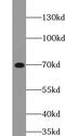 Zeta Chain Of T Cell Receptor Associated Protein Kinase 70 antibody, FNab09583, FineTest, Western Blot image 
