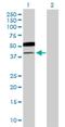 UDP-GlcNAc:betaGal beta-1,3-N-acetylglucosaminyltransferase 5 antibody, H00084002-B01P, Novus Biologicals, Western Blot image 