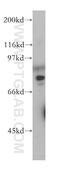 Cell cycle checkpoint protein RAD17 antibody, 13358-1-AP, Proteintech Group, Western Blot image 