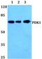 3-Phosphoinositide Dependent Protein Kinase 1 antibody, PA5-36071, Invitrogen Antibodies, Western Blot image 