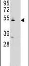 Zinc Finger DHHC-Type Containing 2 antibody, PA5-25504, Invitrogen Antibodies, Western Blot image 