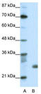Sin3A Associated Protein 30 antibody, TA343428, Origene, Western Blot image 
