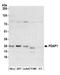 PDGFA Associated Protein 1 antibody, A304-651A, Bethyl Labs, Western Blot image 