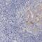 Adipogenesis Associated Mth938 Domain Containing antibody, PA5-58165, Invitrogen Antibodies, Immunohistochemistry frozen image 