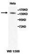 ADAM Metallopeptidase With Thrombospondin Type 1 Motif 18 antibody, orb77737, Biorbyt, Western Blot image 