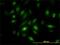 NIMA Related Kinase 10 antibody, H00152110-M01, Novus Biologicals, Immunofluorescence image 