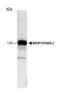BRCA1 Interacting Protein C-Terminal Helicase 1 antibody, NB100-189, Novus Biologicals, Western Blot image 