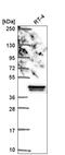 NFKB Inhibitor Beta antibody, HPA063734, Atlas Antibodies, Western Blot image 