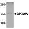 Ski2 Like RNA Helicase antibody, TA349108, Origene, Western Blot image 