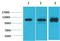 Calcium Voltage-Gated Channel Auxiliary Subunit Alpha2delta 2 antibody, STJ97511, St John
