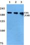 Complement C4A (Rodgers Blood Group) antibody, A01095-1, Boster Biological Technology, Western Blot image 