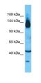 Solute Carrier Family 12 Member 2 antibody, orb330343, Biorbyt, Western Blot image 