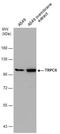 Short transient receptor potential channel 6 antibody, NBP2-20737, Novus Biologicals, Western Blot image 
