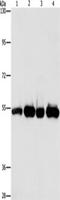 Phosphodiesterase 4D antibody, TA349429, Origene, Western Blot image 