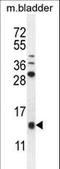 Keratinocyte-associated protein 2 antibody, LS-C165652, Lifespan Biosciences, Western Blot image 