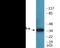 Protein Phosphatase 2 Catalytic Subunit Alpha antibody, EKC2110, Boster Biological Technology, Western Blot image 