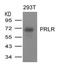 PRL-R antibody, AP26068PU-S, Origene, Western Blot image 