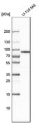 Lysosome membrane protein 2 antibody, HPA018014, Atlas Antibodies, Western Blot image 