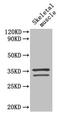Troponin T2, Cardiac Type antibody, LS-C211523, Lifespan Biosciences, Western Blot image 