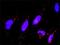 Dual Specificity Phosphatase 1 antibody, H00001843-M02, Novus Biologicals, Proximity Ligation Assay image 