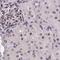 Coiled-Coil Domain Containing 86 antibody, PA5-59617, Invitrogen Antibodies, Immunohistochemistry frozen image 
