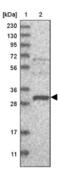 EF-Hand Calcium Binding Domain 2 antibody, NBP1-81219, Novus Biologicals, Western Blot image 