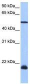 Dyslexia susceptibility 1 candidate gene 1 protein antibody, TA340262, Origene, Western Blot image 