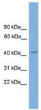 Visual System Homeobox 1 antibody, TA329972, Origene, Western Blot image 