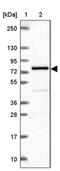 Polypeptide N-Acetylgalactosaminyltransferase 7 antibody, PA5-64163, Invitrogen Antibodies, Western Blot image 