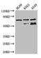 Arginyl-tRNA synthetase, cytoplasmic antibody, A63282-100, Epigentek, Western Blot image 