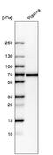 Transforming Growth Factor Beta Induced antibody, HPA017019, Atlas Antibodies, Western Blot image 