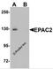 Rap Guanine Nucleotide Exchange Factor 4 antibody, 6633, ProSci Inc, Western Blot image 