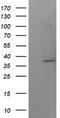 SUMO1 Activating Enzyme Subunit 1 antibody, TA506071, Origene, Western Blot image 
