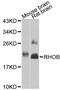 Ras Homolog Family Member B antibody, LS-C747507, Lifespan Biosciences, Western Blot image 