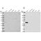 Coenzyme Q2, Polyprenyltransferase antibody, PA5-64380, Invitrogen Antibodies, Western Blot image 