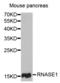 Ribonuclease pancreatic antibody, abx004739, Abbexa, Western Blot image 