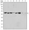 Aurora Kinase A antibody, NBP2-22118, Novus Biologicals, Western Blot image 