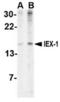 Radiation-inducible immediate-early gene IEX-1 antibody, TA306438, Origene, Western Blot image 