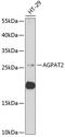1-Acylglycerol-3-Phosphate O-Acyltransferase 2 antibody, 22-280, ProSci, Western Blot image 
