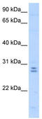 Mediator of RNA polymerase II transcription subunit 4 antibody, TA339712, Origene, Western Blot image 