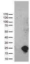 Ubiquitin Conjugating Enzyme E2 N Like (Gene/Pseudogene) antibody, TA812448, Origene, Western Blot image 
