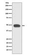 Paired Box 6 antibody, M00273-2, Boster Biological Technology, Western Blot image 