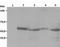 LYN Proto-Oncogene, Src Family Tyrosine Kinase antibody, NB500-519, Novus Biologicals, Western Blot image 