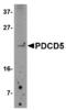 Programmed cell death protein 5 antibody, LS-C82924, Lifespan Biosciences, Western Blot image 