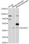 UDP-GlcNAc:betaGal beta-1,3-N-acetylglucosaminyltransferase 6 antibody, LS-C749952, Lifespan Biosciences, Western Blot image 