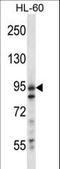 Ubiquitin carboxyl-terminal hydrolase 20 antibody, LS-C160471, Lifespan Biosciences, Western Blot image 